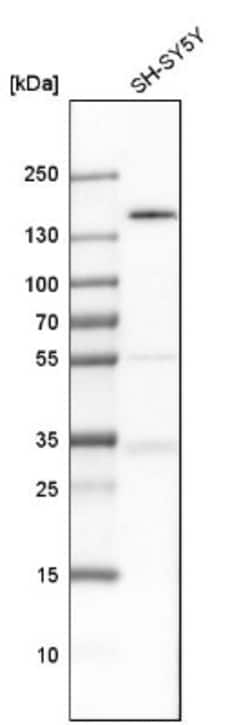TULP4 Antibody, Novus Biologicals 0.1mL; Unlabeled:Antibodies, Polyclonal